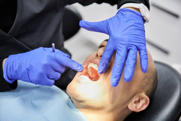 Best Emergency Tooth Extraction in Oroville East, CA